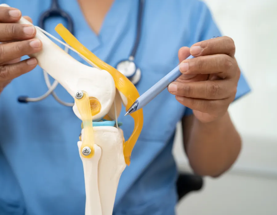 Clinician in scrubs holding an anatomical knee joint model, illustrating orthopedic joint conditions